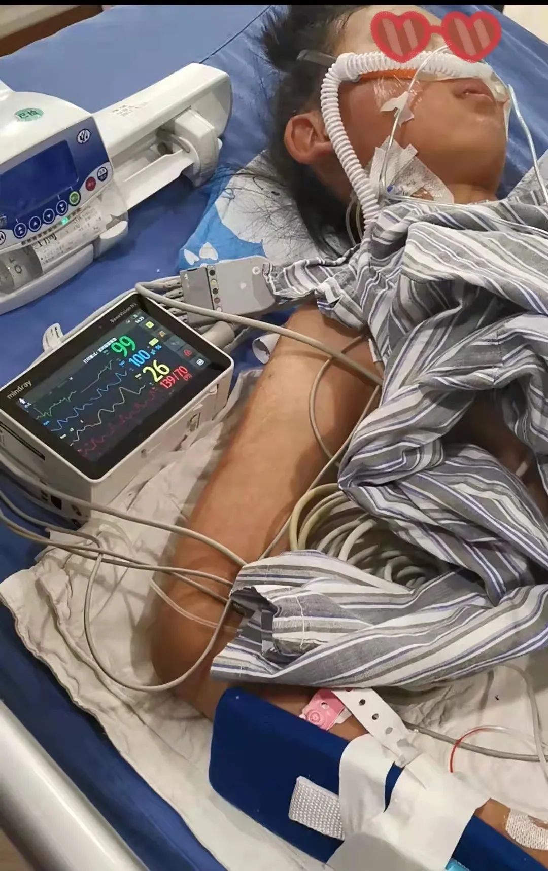 手术前的拉则.jpg 手术前的拉则.jpg